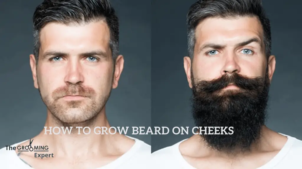 How to Grow Beard on Cheeks